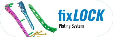 fixLOCK Plating System Brand Logo