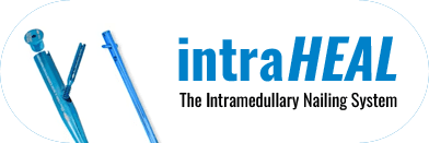 intraHEAL Tibial Intramedullary Nailing System