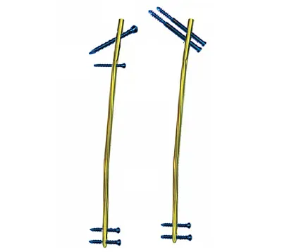 intraHEAL Multi Angle Femoral Nail MLFN09-12